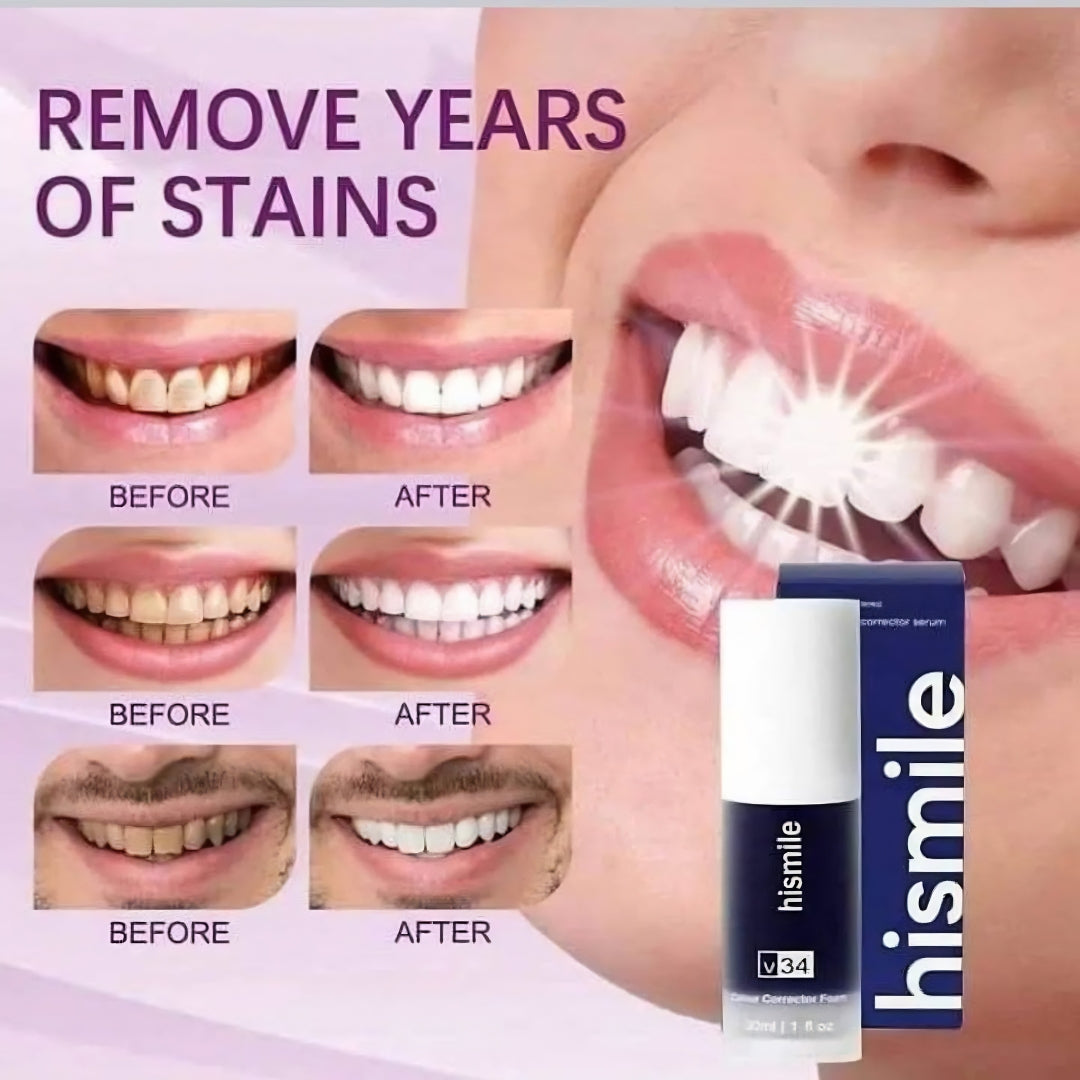 HiSmile V34 Teeth Whitening Purple Toothpaste – Color Corrector for Brighter White Teeth