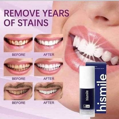 HiSmile V34 Teeth Whitening Purple Toothpaste – Color Corrector for Brighter White Teeth